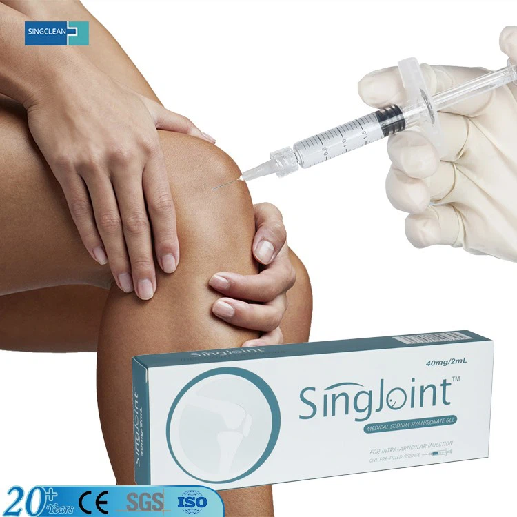 Singjoint 02 Singjoint 02